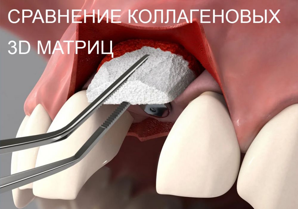 Не все коллагеновые матриксы одинакового работают