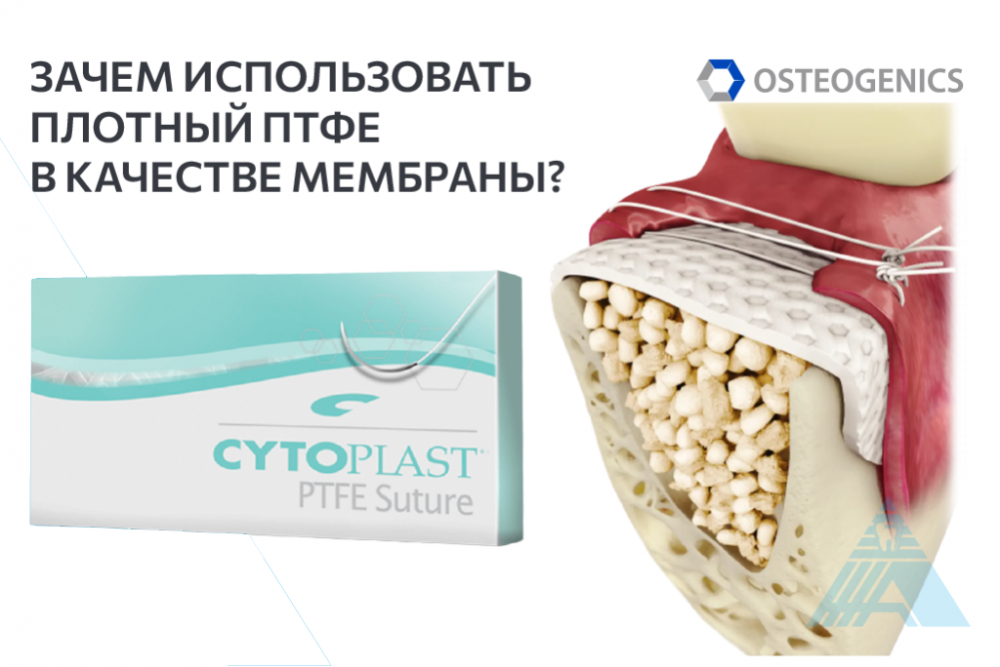 Зачем использовать плотный ПТФЕ в качестве мембраны?