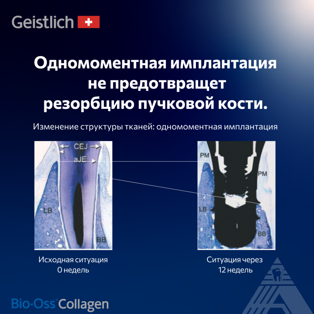 Концепция постэкстракционного ведения лунки