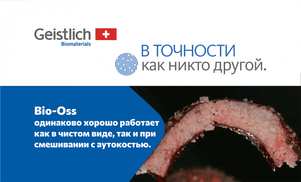 Клинический случай dr. Амели Хартман «Обширная костная аугментация»
