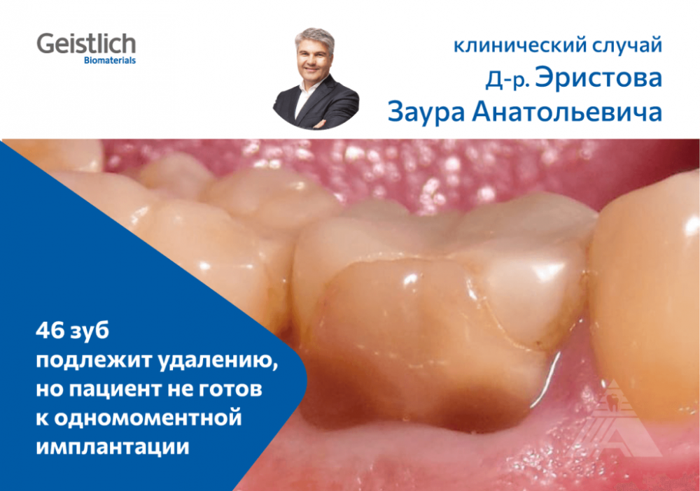 Такая задача стояла перед экспертом одномоментных операций