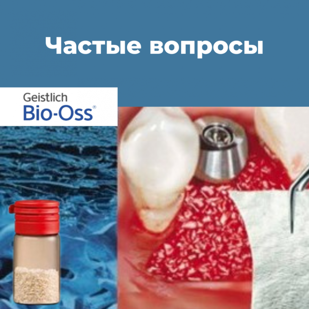 Топ «мифов» про крупные гранулы «L» Bio-oss Geistlich