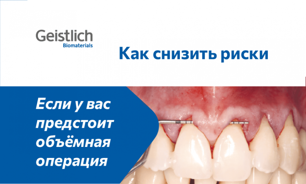 Рассмотрим на примере