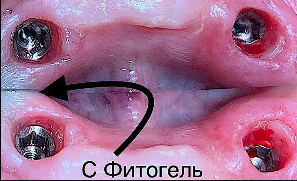 Менеджмент десны.jpg Менеджмент десны.jpg