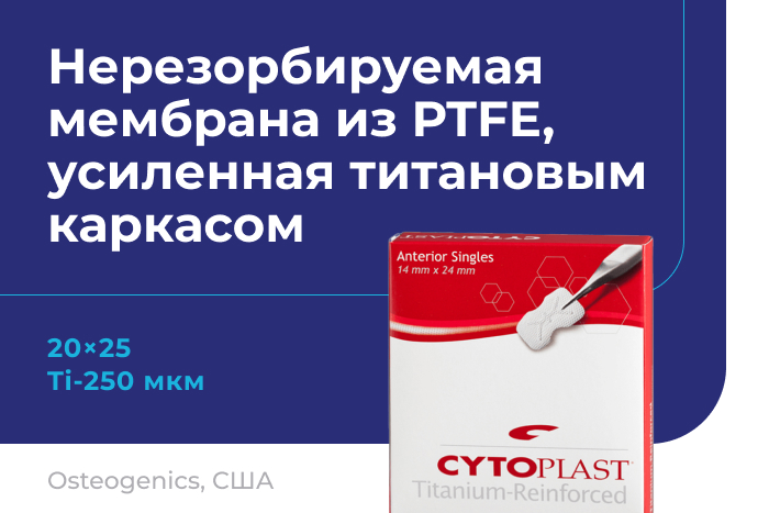 Мембрана Cytoplast Ti-250 снова в России!
