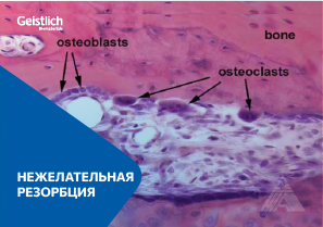 Это естественный процесс разрушения костной ткани