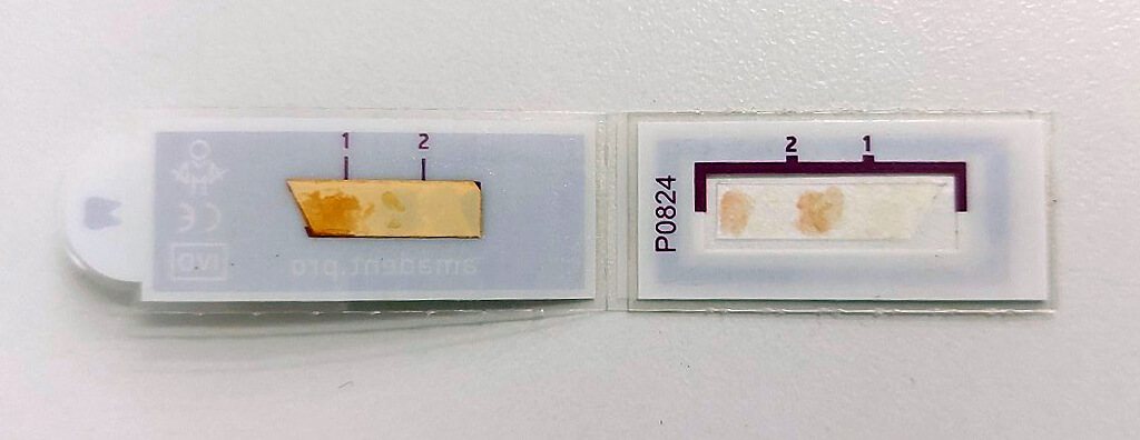 Использование теста AMA DENT_итог